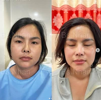 Slider image (1) Dr. Nhan Ho Aesthetics and Plastic Surgery